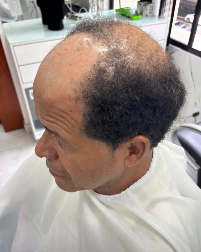 Cliente da Recriare Beleza antes da prótese capilar